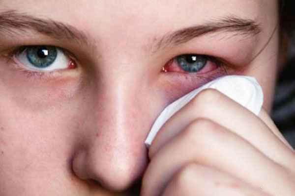آشنایی با داروی کلرامفنیکل و موارد مصرف آن